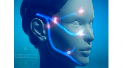 Опубликованы рекомендации European Academy of Neurology по диагностике и лечению тригеминальной невралгии