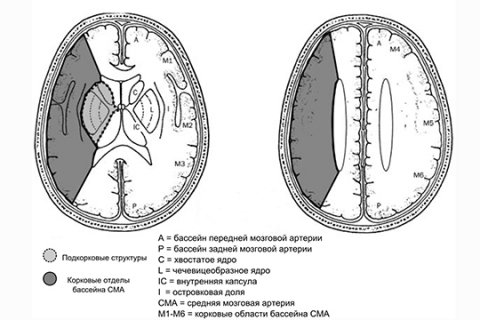 Рисунок 4. Шкала ASPECTS Рисунок 4. Шкала ASPECTS